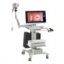 Digital Video Colposcope for Gynecology